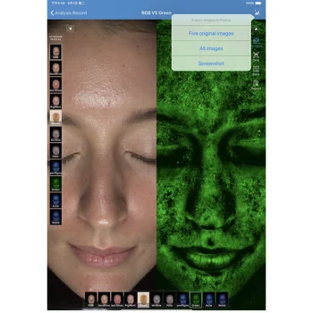 Анализатор кожи лица Meicet, машина для определения пяти спектров, тестовая машина для лица